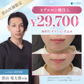  【雲山ドクター限定】アラガン社製ヒアルロン酸注入 1cc｜ジュビダームビスタ®︎シリーズ