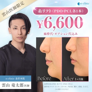  【雲山ドクター執刀】戻りにくい糸リフト｜PDO・PCL