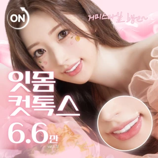 온리프 잇몸보톡스, 거미스마일 bye 잇몸컷톡스