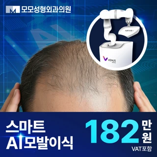 스마트 AI 모발이식