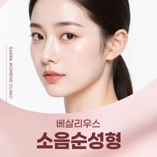 베살리우스 소음순성형 이벤트