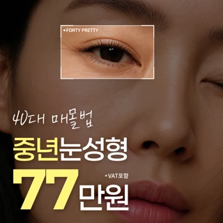 나아 중년눈성형 40대 매몰법 자연유착