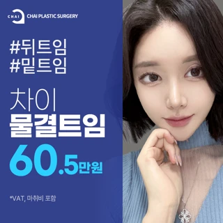 차이 물결트임_뒤트임, 밑트임, 트임