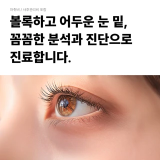대구 눈밑지방재배치 눈밑리프팅