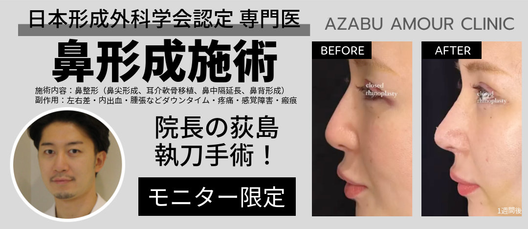 鼻形成手術【形成外科専門医の院長が担当】 | AZABU AMOUR CLINIC
