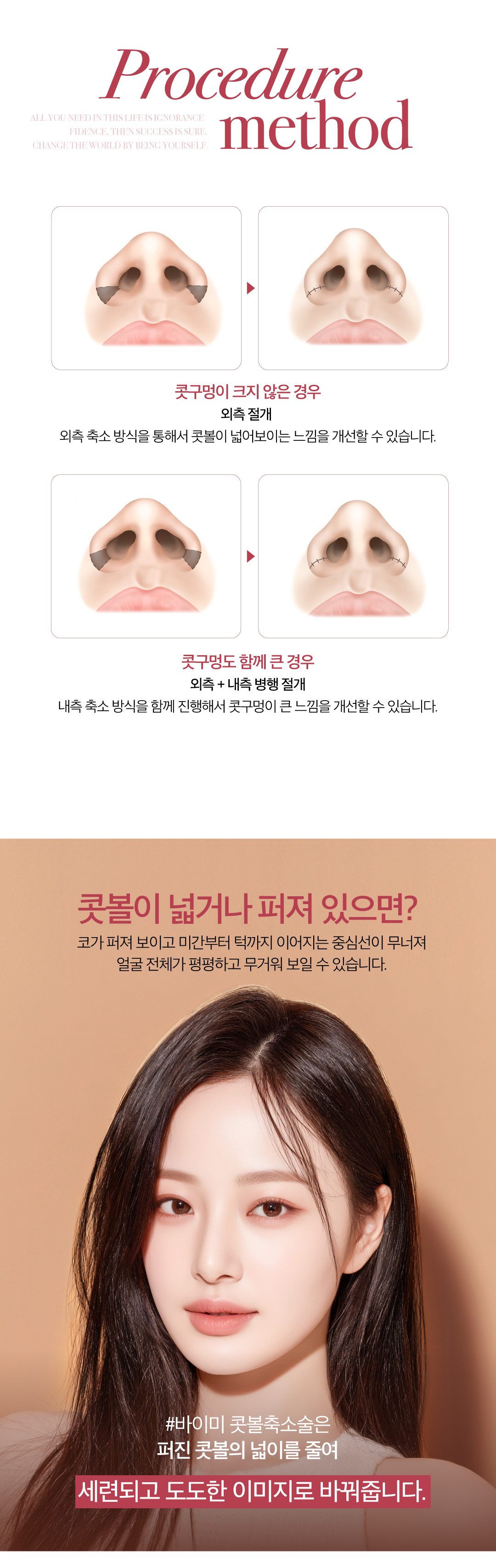 내가 원하는 방식으로 내가 원하는 만큼 넓은 복코 고민 교정하는 콧볼축소술