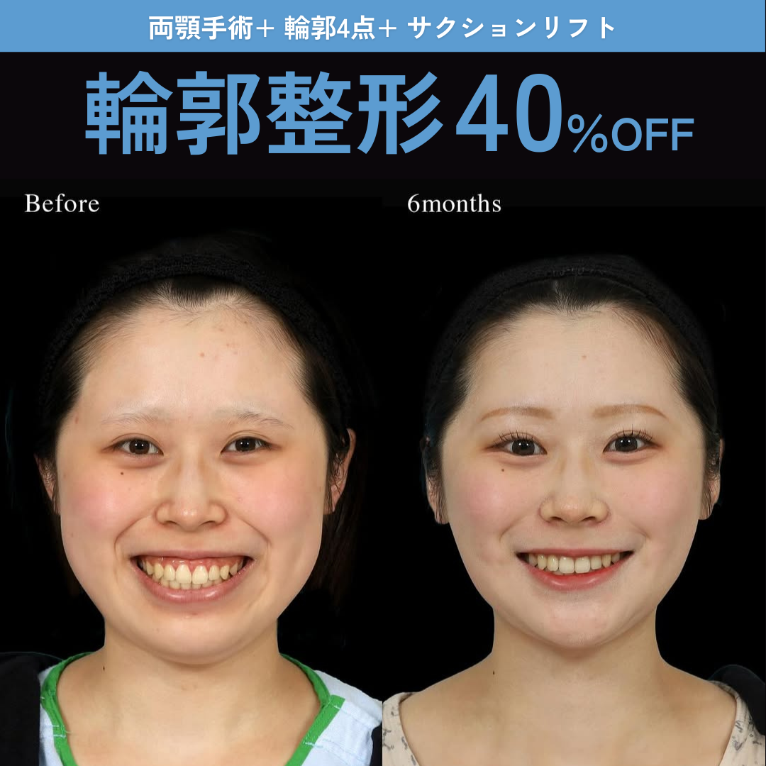顔面輪郭/両顎の手術後、顎の下に肉？ おすすめクリニック・値段