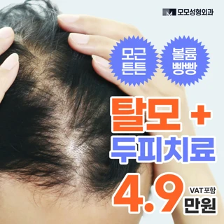 볼륨빵빵 모모 탈모치료