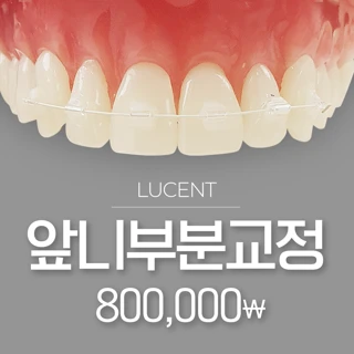 예쁘게 빠르게 앞니 부분교정