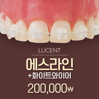 뿌리손상 없이 빠른 에스라인 치아교정
