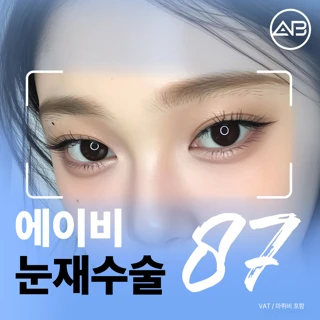 에이비 눈재수술