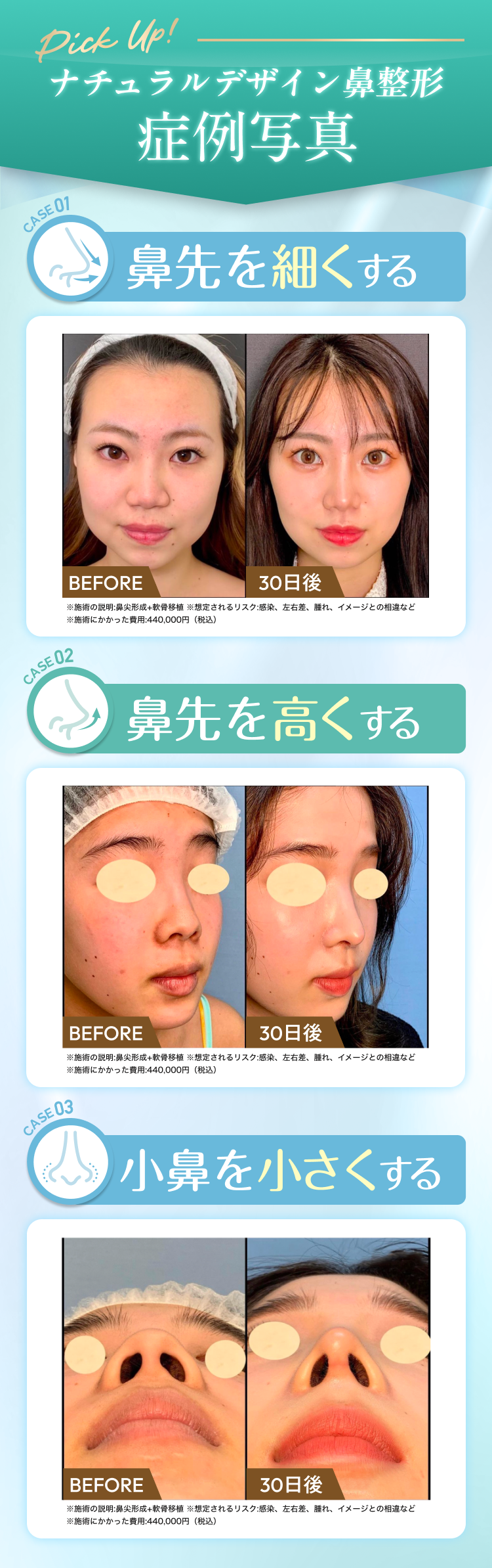 選べるメニュー】オーダーメイド鼻尖形成【モニター】 | eクリニック岡山院, image size:750x2387