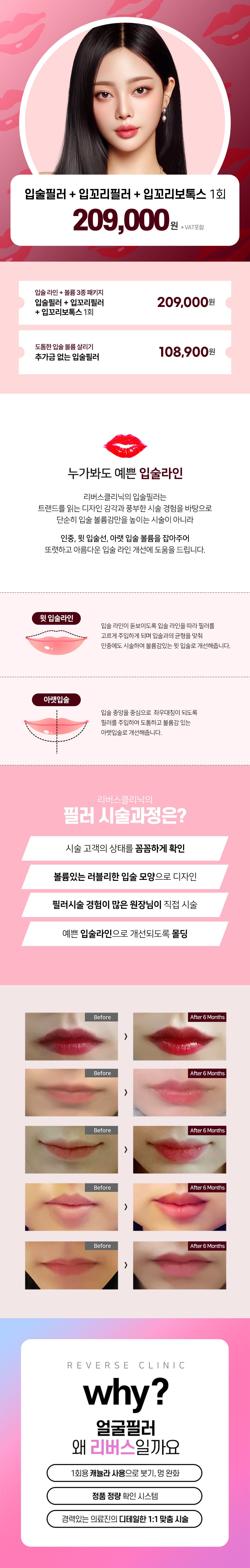 도톰하고 러블리한 입술라인이 갖고싶다면