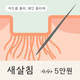 새살침 - 여드름흉터, 수두흉터 등 모든 패인흉터 치료, 첫내원 이벤트