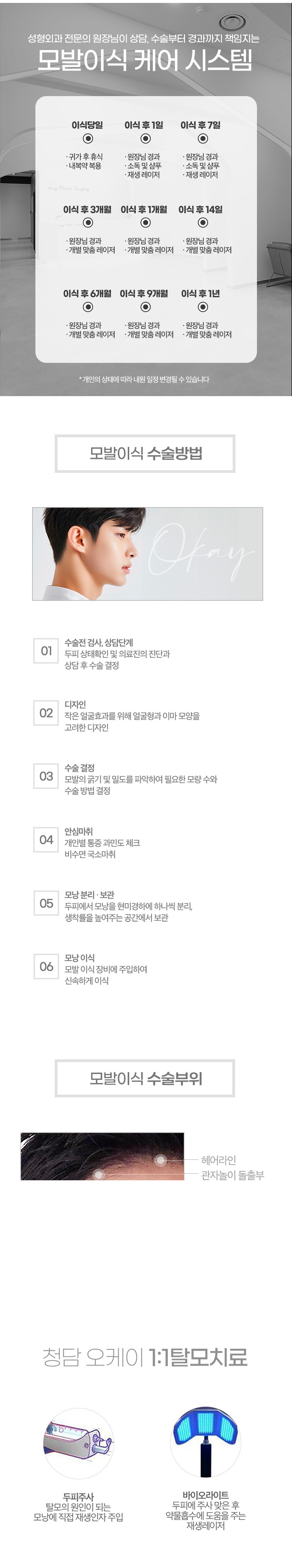 넓은이마, M자이마, 탈모, 헤어라인이식, 모발이식 모두 ok