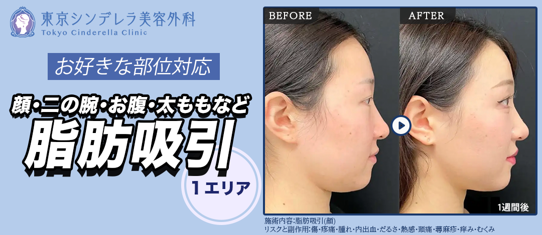 脂肪吸引（顔・二の腕・お腹・太ももなど）お好きな1部位から1エリア