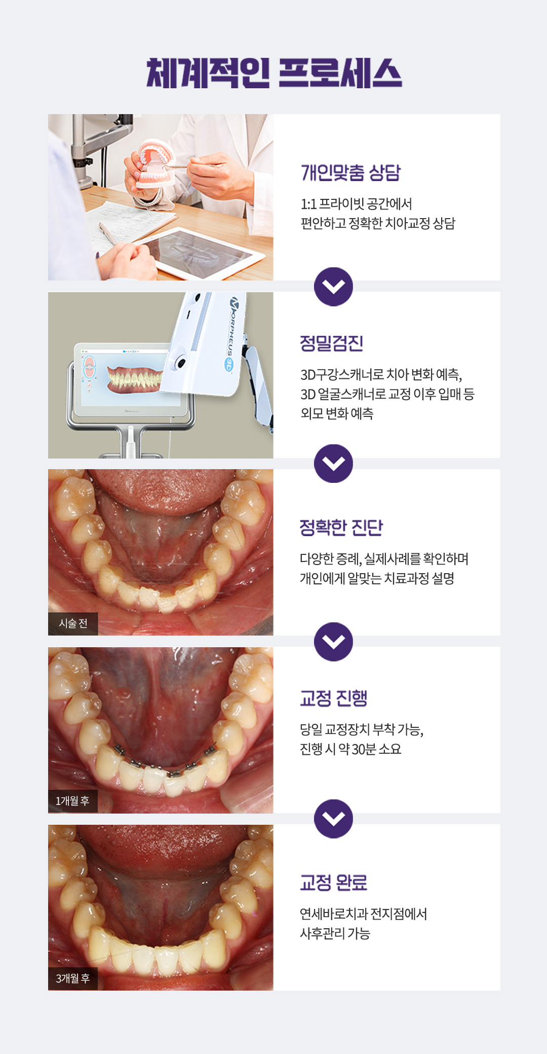 치과교정과 전문의가 직접 진료하는 심미교정, 안 보이는 앞니교정.