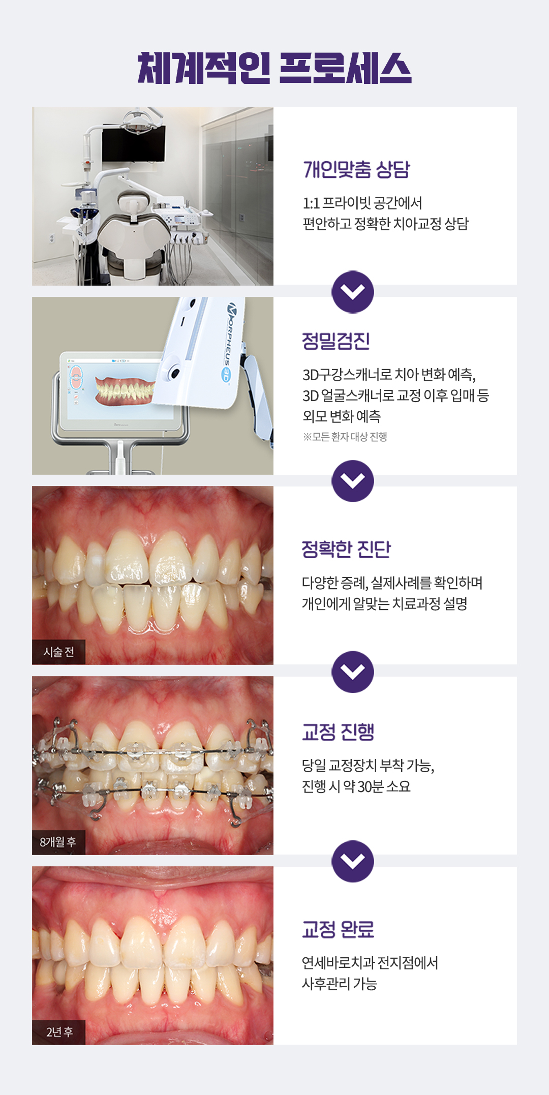 통증, 치과방문 횟수, 교정기간, 심미성 걱정을 줄인 편안한 치아교정 클리피씨