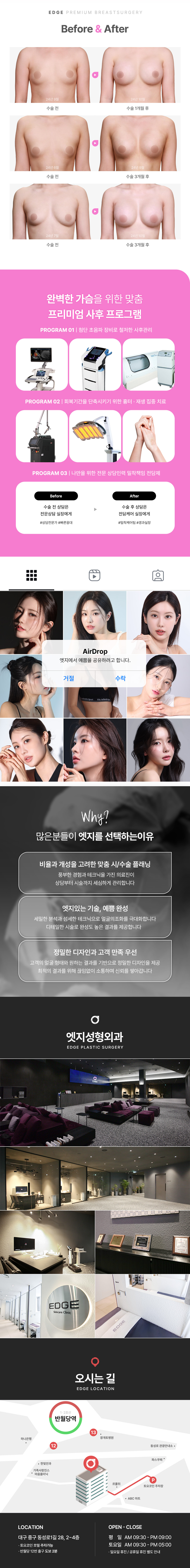 물방울 맺힌 듯 말랑한 아름다운 가슴라인! 엣지에서 만나보세요!