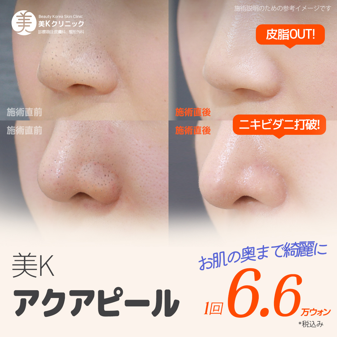 肌質 フルフェイス脱毛ソウル皮膚科をおすすめしてください！ 人気順