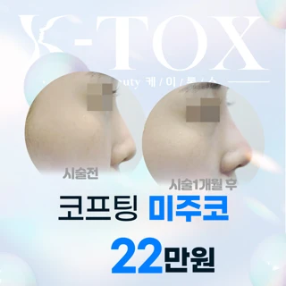 오똑한코 2x미주코 