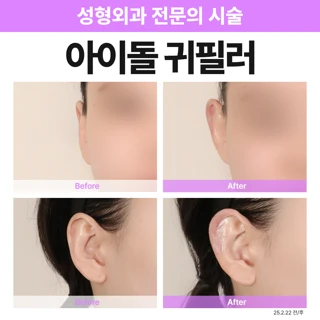 귀필러_누운귀, 작은귀, 귓볼필러
