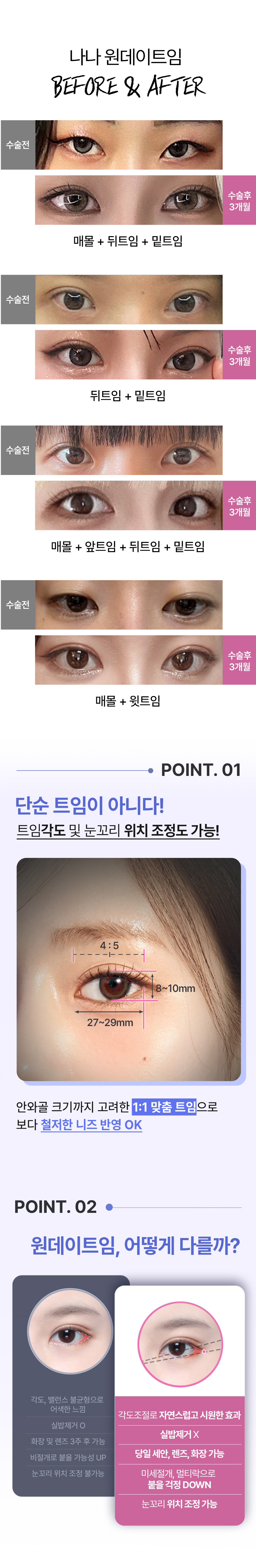 당일 세안,메이크업,렌즈착용가능 하루만에 순싹커지는 원데이트임_앞트임, 위트임, 뒤트임, 밑트임, 눈꼬리내리기 중 선택