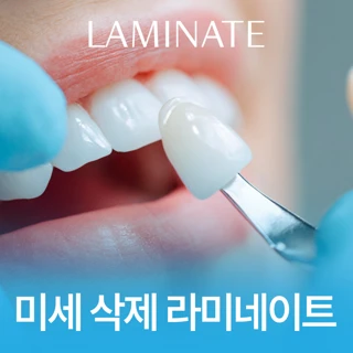 고급진 사람의 비결, 라미네이트시술 받고 예뻐지자