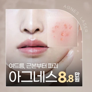아그네스로 여드름 근본 파괴