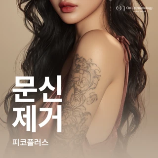 잠실온피부과_문신제거