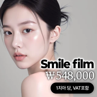 스마일필름 라미네이트 - 얇고 자연스럽게 미소 연출