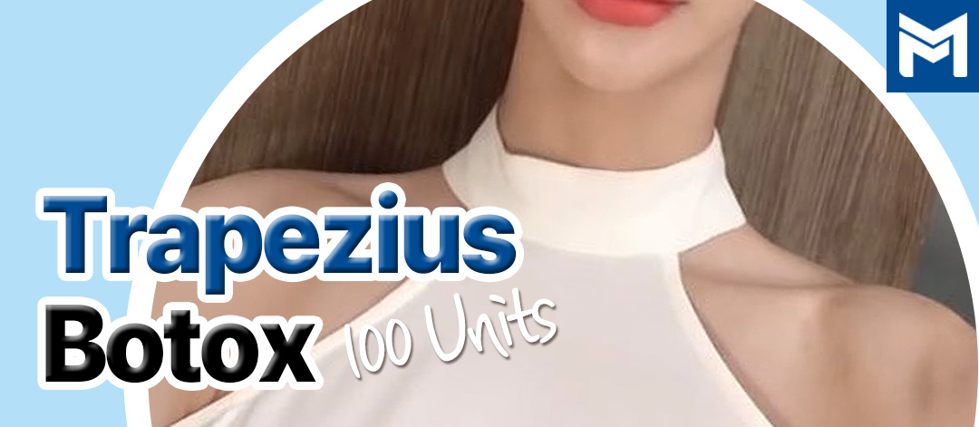 Shoulder Botox Injection Trapezius Botox 100 Units — Shoulder Injection, Shoulder Botox ...