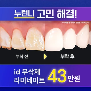 라미네이트 고민끝, 아이디 무삭제 라미네이트