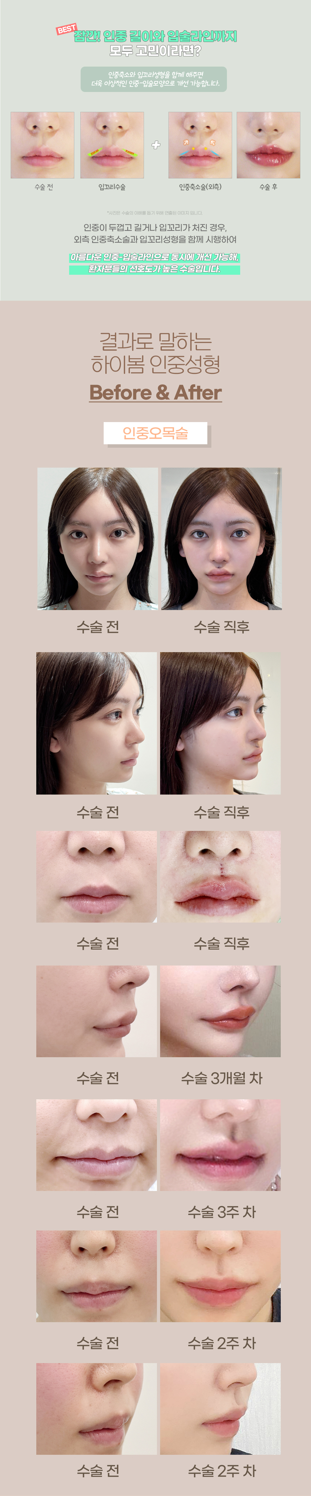  수험생대상_자연스럽게 예뻐지는 하이봄