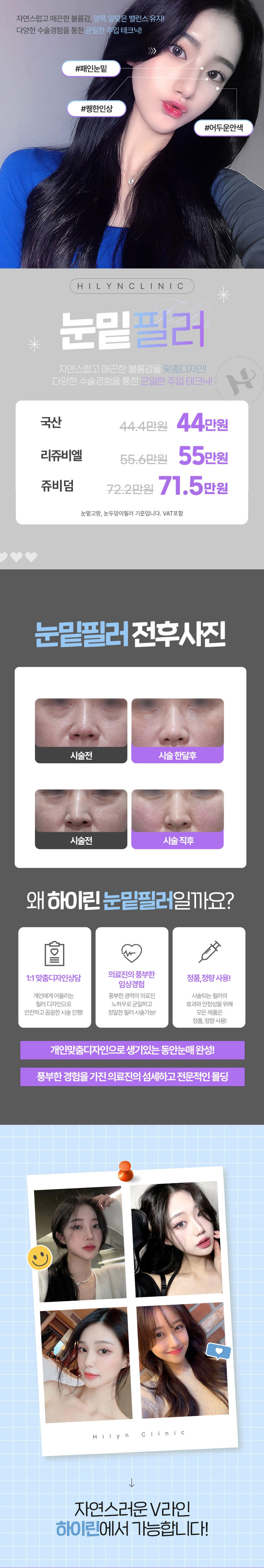 피곤해 보이는 눈밑을 자연스러운 1:1 맞춤 디자인 및 
풍부한 경력의 의료진 시술로 균일하고 정밀한 필러시술로 매끄럽고 생기있게 만들어 드립니다.
