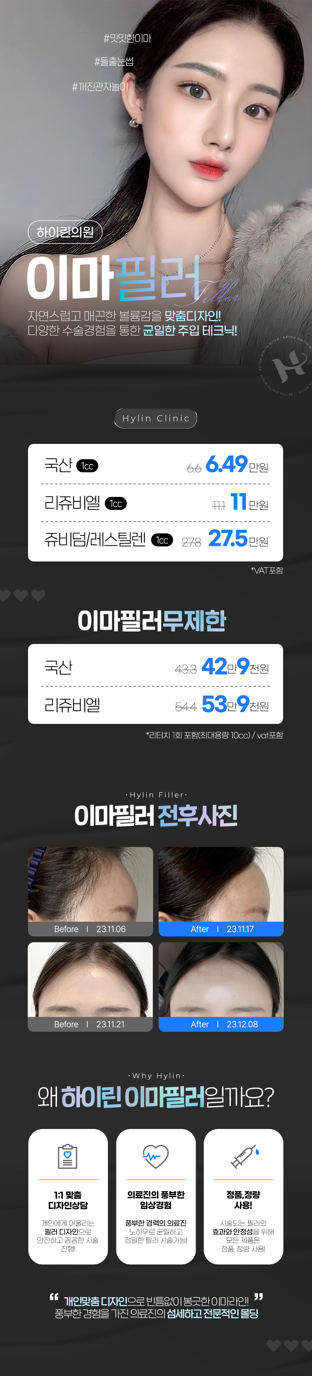 자연스럽고 매끄러운 볼륨감을 위한 하이린의 맞춤필러 디자인
다양한 시술경험을 통한 균일하고 자연스러운 주입테크닉