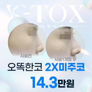 오똑한코 2X미주코