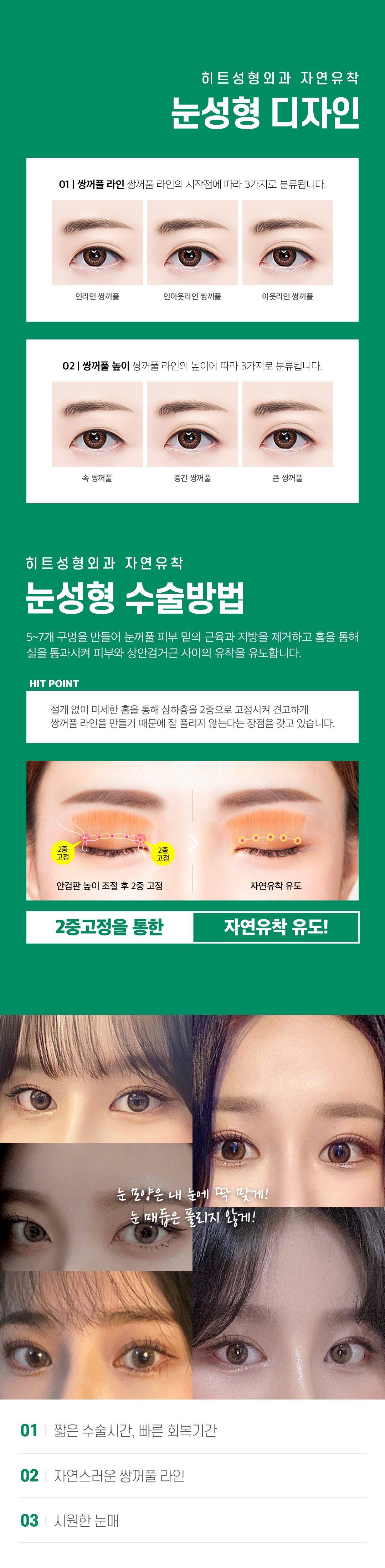 히트한 눈성형 수험생을 위한 수능이벤트 자연유착 쌍꺼풀 눈성형 매몰 