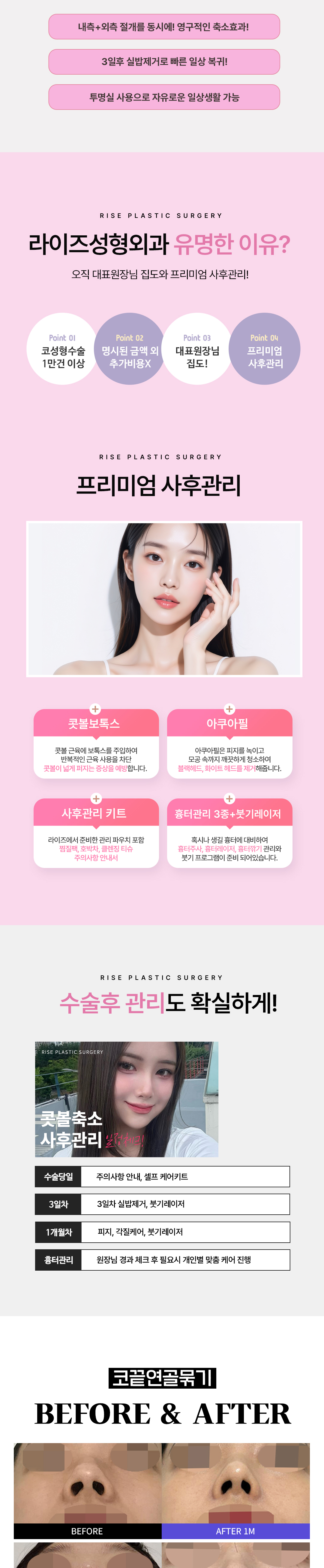 콧볼장인 임정택 원장님의 오랜 경험과 노하우로 
만족도 높은 결과를 드리겠습니다.

- 정직한 진료
- 안전한 수술
- 프라이빗한 회복실
- 1:1 맞춤상담과 디자인
- 수술시간 20분 내외 / 3일차 실밥제거 
- 사후관리 풀패키지 포함 / 추가비용 X