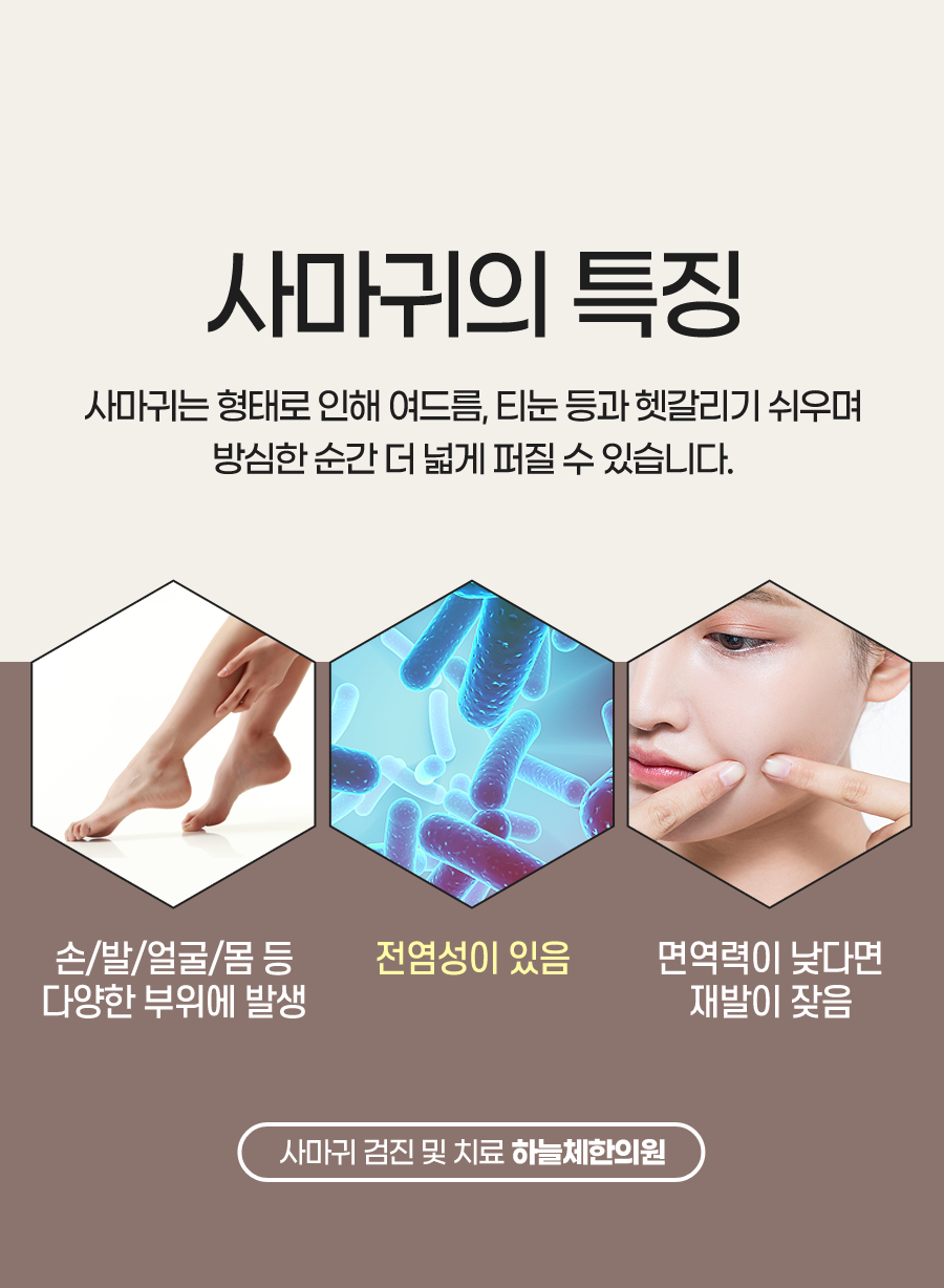 원장님이 직접 정성들여 시술하는 사마귀 제거 할인이벤트!