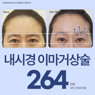 리앤리 내시경 이마거상-엔도타인