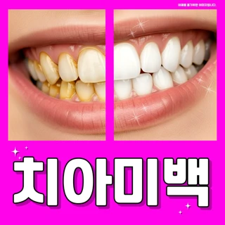 원데이 치아미백