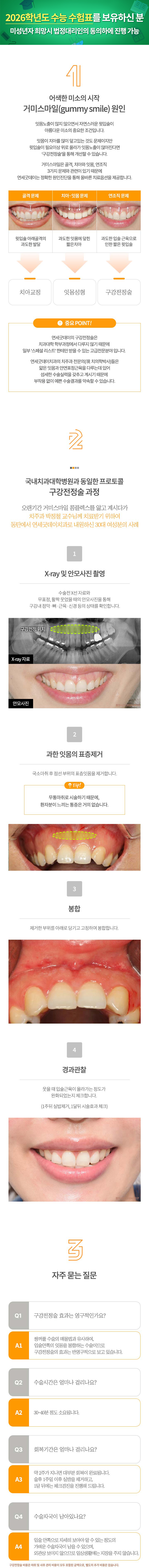 구강전정술(입술재배치술)은 윗입술이 과도하게 올라가지 않도록, 입술의 움직임을 제한하여 잇몸을 덜 보이게 도와주는 수술입니다.