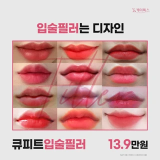 큐피트 입술필러 입꼬리필러