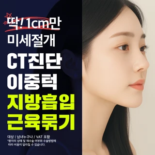 다이어트를 해도 잘 빠지지 않은 투턱_CT진단 이중턱 지방흡입, 근육묶기