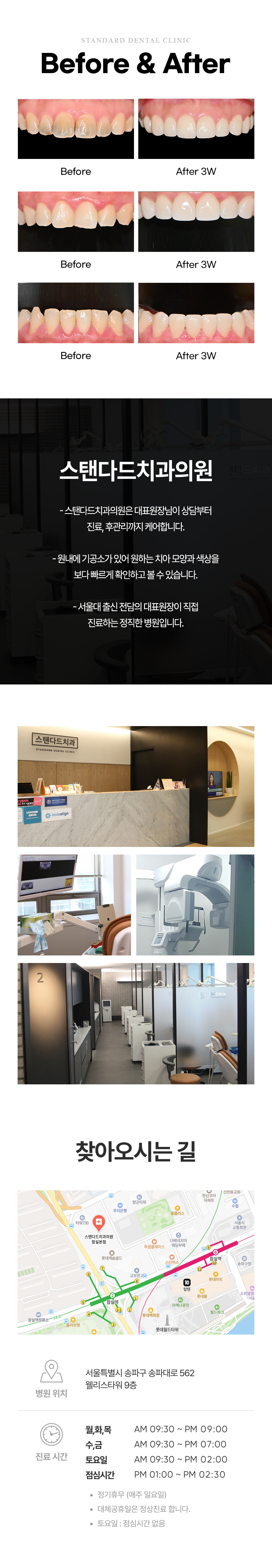 [바이오닉 라미네이트 (Bionic Laminate)]
스탠다드치과의 바이오닉 라미네이트는 자연치아를 최대한 보존하면서 기능적·심미적으로 복원하는 라미네이트입니다.
‘Bionic’이라는 단어는 생체를 모방한다는 뜻으로, 이 시술은 자연치아의 구조와 성질을 그대로 재현하는 복원치료(Biomimetic Restoration) 개념에 기반합니다.
단순히 치아를 덮는 것이 아니라, 치아 본연의 형태·색감·기능을 되살리는 데 초점을 둔 시술입니다.

기존 라미네이트가 일정 부분의 치아를 삭제하고 인공 보철물로 덮는 방식이었다면, 바이오닉 라미네이트는 필요한 부위만 최소한으로 다듬어 자연치아를 최대한 보존합니다.
이 과정에서 사용하는 재료 또한 자연치아와 유사한 물성을 가진 생체친화적 세라믹 복합소재로, 치아 본연의 투명도와 질감을 유지하면서 강도와 접착력도 우수합니다.
그 결과, 치아 삭제로 인한 시림이나 손상 부담을 최소화하면서 오랫동안 안정적인 결과를 기대할 수 있습니다.

또한 바이오닉 라미네이트는 단순히 심미성에 그치지 않습니다.
저작(씹는 기능), 교합(물림), 발음까지 고려한 기능적 복원을 통해 치아가 단순히 ‘예뻐 보이는 것’을 넘어 본래의 역할을 되찾는 시술을 목표로 합니다.
기존 라미네이트의 단점이었던 불편한 이물감이나 인위적인 인상 대신, 자연스러운 미소선과 입모양을 만들어주는 것이 특징입니다.

[스탠다드치과 잠실점만의 특별함]
스탠다드치과 잠실점은 서울대학교 출신 치과보철과 전문의, 대표원장이 직접 시술 전 과정을 담당합니다.
시술 전 3D 구강 스캔과 디지털 디자인을 통해 결과를 예측할 수 있는 정밀 계획 시스템을 갖추고 있으며, 환자의 치아 구조, 교합 상태, 얼굴형, 미소선 등을 종합 분석해 개인 맞춤형 디자인을 제공합니다.
또한 시술 과정 전반에서 <‘꼭 필요한 만큼만 진행하는 상담 원칙’>을 고수해 불필요한 치료를 권하지 않고, 환자 스스로 충분히 이해하고 결정할 수 있도록 돕습니다.

치료 후에도 자연치아와의 경계가 거의 보이지 않는 자연스러운 심미성, 튼튼한 접착력, 장기적인 안정성으로 만족도가 높은 시술입니다.
스탠다드치과 잠실점에서는 단순히 ‘예쁜 치아’를 만드는 것이 아니라 치아 본연의 기준을 지키며, 기능과 아름다움을 함께 복원하는 라미네이트를 지향합니다.