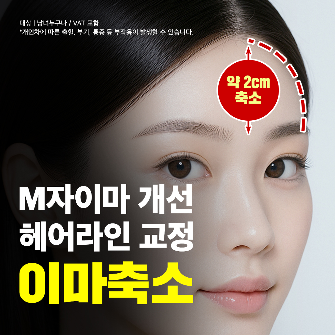 모근을 살려 이마축소와 헤어라인 교정까지