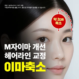 모근을 살려 이마축소와 헤어라인 교정까지