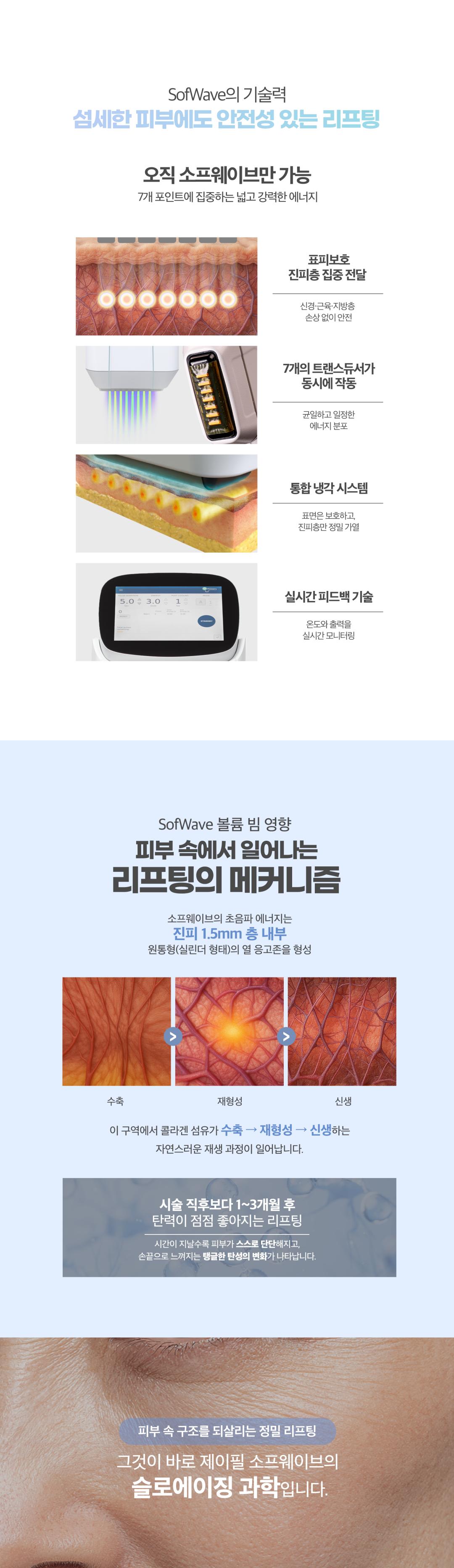 피부 속 진피층까지 강력한 초음파 리프팅, 탄력 에너지 UP

POINT
7개의 초음파 열기둥이 진피층을 정밀하게 자극해
콜라겐 재생과 엘라스틴 생성을 동시에 촉진,
피부 탄력과 리프팅 효과를 극대화

EFFECT
1회 시술만으로 느껴지는 즉각적인 탄력 개선,
이중턱·팔자·목주름까지 한 번에 케어하는
비수술 초음파 리프팅