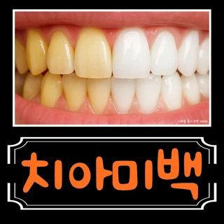 원데이 치아미백